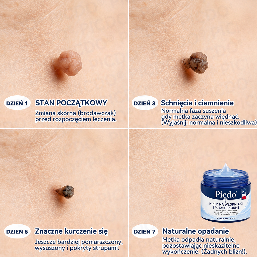🔥🔥𝐏𝐢𝐜𝐝𝐨® 7-𝐃𝐧𝐢𝐨𝐰𝐲 𝐊𝐫𝐞𝐦 𝐝𝐨 𝐔𝐬𝐮𝐰𝐚𝐧𝐢𝐚 𝐁𝐫𝐨𝐝𝐚𝐰𝐞𝐤 𝐢 𝐍𝐢𝐞𝐝𝐨𝐬𝐤𝐨𝐧𝐚𝐥𝐨ś𝐜𝐢 𝐒𝐤ó𝐫𝐲🩵 (𝑭𝒐𝒓𝒎𝒖ł𝒂 𝑩𝒆𝒛 𝑩ó𝒍𝒖 𝒊 𝑩𝒆𝒛 𝑩𝒍𝒊𝒛𝒏) 💪
