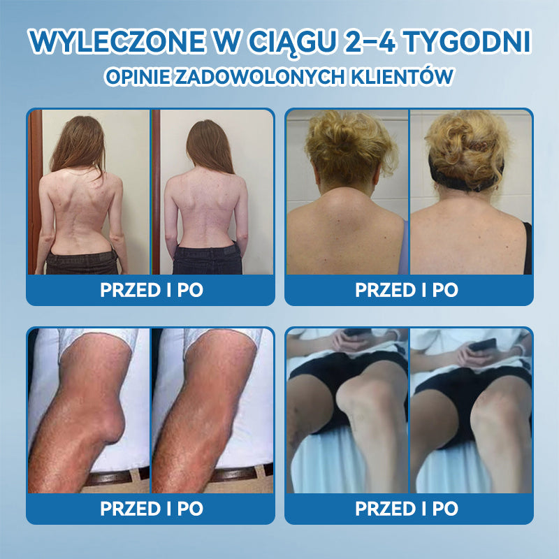𝐎𝐟𝐢𝐜𝐣𝐚𝐥𝐧𝐲 𝐬𝐤𝐥𝐞𝐩| 👩‍⚕️🎁𝖯𝗂𝖼𝗱𝗼® 𝐵𝑃𝐶-157 𝐾𝑟𝑒𝑚 𝑑𝑜 𝑙𝑒𝑐𝑧𝑒𝑛𝑖𝑎 𝑠𝑡𝑎𝑤ó𝑤🦴𝐷𝑧𝑖𝑎ł𝑎 𝑤 5 𝑚𝑖𝑛𝑢𝑡 — 𝑙𝑒𝑐𝑧𝑦 𝑎𝑟𝑡𝑟𝑒𝑡𝑦𝑧𝑚, 𝑛𝑒𝑢𝑟𝑜𝑝𝑎𝑡𝑖ę, 𝑟𝑒𝑢𝑚𝑎𝑡𝑦𝑧𝑚, 𝑢𝑟𝑎𝑧𝑦 𝑠𝑝𝑜𝑟𝑡𝑜𝑤𝑒 𝑖 𝑖𝑛𝑛𝑒 👍