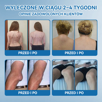 𝐎𝐟𝐢𝐜𝐣𝐚𝐥𝐧𝐲 𝐬𝐤𝐥𝐞𝐩| 👩‍⚕️🎁𝖯𝗂𝖼𝗱𝗼® 𝐵𝑃𝐶-157 𝐾𝑟𝑒𝑚 𝑑𝑜 𝑙𝑒𝑐𝑧𝑒𝑛𝑖𝑎 𝑠𝑡𝑎𝑤ó𝑤🦴𝐷𝑧𝑖𝑎ł𝑎 𝑤 5 𝑚𝑖𝑛𝑢𝑡 — 𝑙𝑒𝑐𝑧𝑦 𝑎𝑟𝑡𝑟𝑒𝑡𝑦𝑧𝑚, 𝑛𝑒𝑢𝑟𝑜𝑝𝑎𝑡𝑖ę, 𝑟𝑒𝑢𝑚𝑎𝑡𝑦𝑧𝑚, 𝑢𝑟𝑎𝑧𝑦 𝑠𝑝𝑜𝑟𝑡𝑜𝑤𝑒 𝑖 𝑖𝑛𝑛𝑒 👍