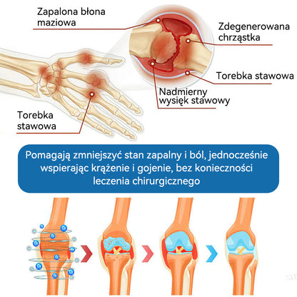 𝐎𝐟𝐢𝐜𝐣𝐚𝐥𝐧𝐲 𝐬𝐤𝐥𝐞𝐩| 👩‍⚕️🎁𝖯𝗂𝖼𝗱𝗼® 𝐵𝑃𝐶-157 𝐾𝑟𝑒𝑚 𝑑𝑜 𝑙𝑒𝑐𝑧𝑒𝑛𝑖𝑎 𝑠𝑡𝑎𝑤ó𝑤🦴𝐷𝑧𝑖𝑎ł𝑎 𝑤 5 𝑚𝑖𝑛𝑢𝑡 — 𝑙𝑒𝑐𝑧𝑦 𝑎𝑟𝑡𝑟𝑒𝑡𝑦𝑧𝑚, 𝑛𝑒𝑢𝑟𝑜𝑝𝑎𝑡𝑖ę, 𝑟𝑒𝑢𝑚𝑎𝑡𝑦𝑧𝑚, 𝑢𝑟𝑎𝑧𝑦 𝑠𝑝𝑜𝑟𝑡𝑜𝑤𝑒 𝑖 𝑖𝑛𝑛𝑒 👍