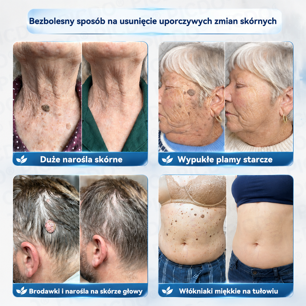 🔥🔥𝐏𝐢𝐜𝐝𝐨® 7-𝐃𝐧𝐢𝐨𝐰𝐲 𝐊𝐫𝐞𝐦 𝐝𝐨 𝐔𝐬𝐮𝐰𝐚𝐧𝐢𝐚 𝐁𝐫𝐨𝐝𝐚𝐰𝐞𝐤 𝐢 𝐍𝐢𝐞𝐝𝐨𝐬𝐤𝐨𝐧𝐚𝐥𝐨ś𝐜𝐢 𝐒𝐤ó𝐫𝐲🩵 (𝑭𝒐𝒓𝒎𝒖ł𝒂 𝑩𝒆𝒛 𝑩ó𝒍𝒖 𝒊 𝑩𝒆𝒛 𝑩𝒍𝒊𝒛𝒏) 💪