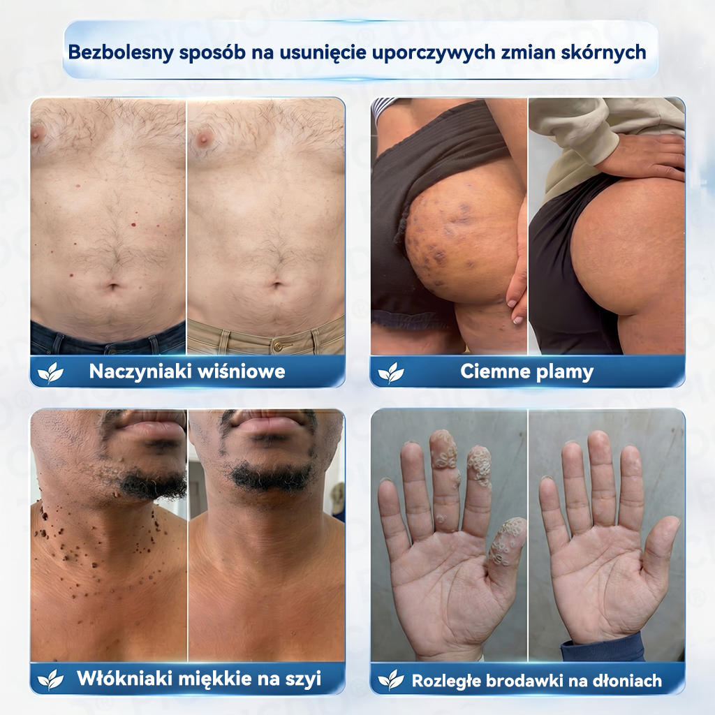 🔥🔥𝐏𝐢𝐜𝐝𝐨® 7-𝐃𝐧𝐢𝐨𝐰𝐲 𝐊𝐫𝐞𝐦 𝐝𝐨 𝐔𝐬𝐮𝐰𝐚𝐧𝐢𝐚 𝐁𝐫𝐨𝐝𝐚𝐰𝐞𝐤 𝐢 𝐍𝐢𝐞𝐝𝐨𝐬𝐤𝐨𝐧𝐚𝐥𝐨ś𝐜𝐢 𝐒𝐤ó𝐫𝐲🩵 (𝑭𝒐𝒓𝒎𝒖ł𝒂 𝑩𝒆𝒛 𝑩ó𝒍𝒖 𝒊 𝑩𝒆𝒛 𝑩𝒍𝒊𝒛𝒏) 💪