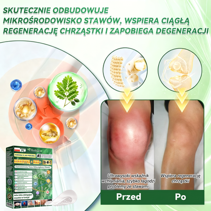 🎖️😍𝐎𝐟𝐢𝐜𝐣𝐚𝐥𝐧𝐲 𝐬𝐤𝐥𝐞𝐩 𝐰 𝐏𝐨𝐥𝐬𝐜𝐞  |  𝐅𝐥𝐨𝐫𝐢𝐬𝐦𝐚® 𝐌𝐎𝐑𝐈𝐍𝐆𝐀•𝐁𝐄𝐑𝐁𝐄𝐑𝐘𝐍Ą 𝟏𝟎 𝐖 𝟏 𝐙𝐚𝐚𝐰𝐚𝐧𝐬𝐨𝐰𝐚𝐧𝐲 𝐍𝐚𝐧𝐨-𝐌𝐢𝐤𝐫𝐨𝐢𝐠ł𝐨𝐰𝐲 𝐏𝐥𝐚𝐬𝐭𝐞𝐫 — 𝐑𝐚𝐳 𝐝𝐳𝐢𝐞𝐧𝐧𝐢𝐞, 𝐰𝐢𝐝𝐨𝐜𝐳𝐧𝐞 𝐞𝐟𝐞𝐤𝐭𝐲 𝐣𝐮ż 𝐩𝐨 𝟕 𝐝𝐧𝐢𝐚𝐜𝐡