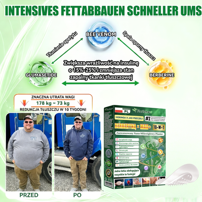 🎖️😍𝐎𝐟𝐢𝐜𝐣𝐚𝐥𝐧𝐲 𝐬𝐤𝐥𝐞𝐩 𝐰 𝐏𝐨𝐥𝐬𝐜𝐞  |  𝐅𝐥𝐨𝐫𝐢𝐬𝐦𝐚® 𝐌𝐎𝐑𝐈𝐍𝐆𝐀•𝐁𝐄𝐑𝐁𝐄𝐑𝐘𝐍Ą 𝟏𝟎 𝐖 𝟏 𝐙𝐚𝐚𝐰𝐚𝐧𝐬𝐨𝐰𝐚𝐧𝐲 𝐍𝐚𝐧𝐨-𝐌𝐢𝐤𝐫𝐨𝐢𝐠ł𝐨𝐰𝐲 𝐏𝐥𝐚𝐬𝐭𝐞𝐫 — 𝐑𝐚𝐳 𝐝𝐳𝐢𝐞𝐧𝐧𝐢𝐞, 𝐰𝐢𝐝𝐨𝐜𝐳𝐧𝐞 𝐞𝐟𝐞𝐤𝐭𝐲 𝐣𝐮ż 𝐩𝐨 𝟕 𝐝𝐧𝐢𝐚𝐜𝐡