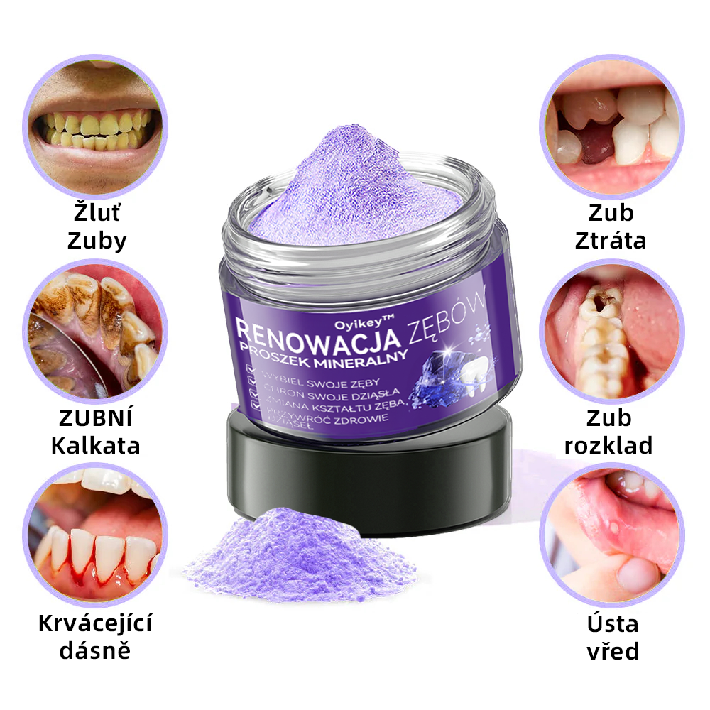 [✅Oficjalny sklep]𝐎𝐲𝐢𝐤𝐞𝐲™ Proszek mineralny do naprawy zębów 🦷 (Rekomendowane przez PTO) (🎁 Limitowana oferta - 70% zniżki - Nie przegap!)