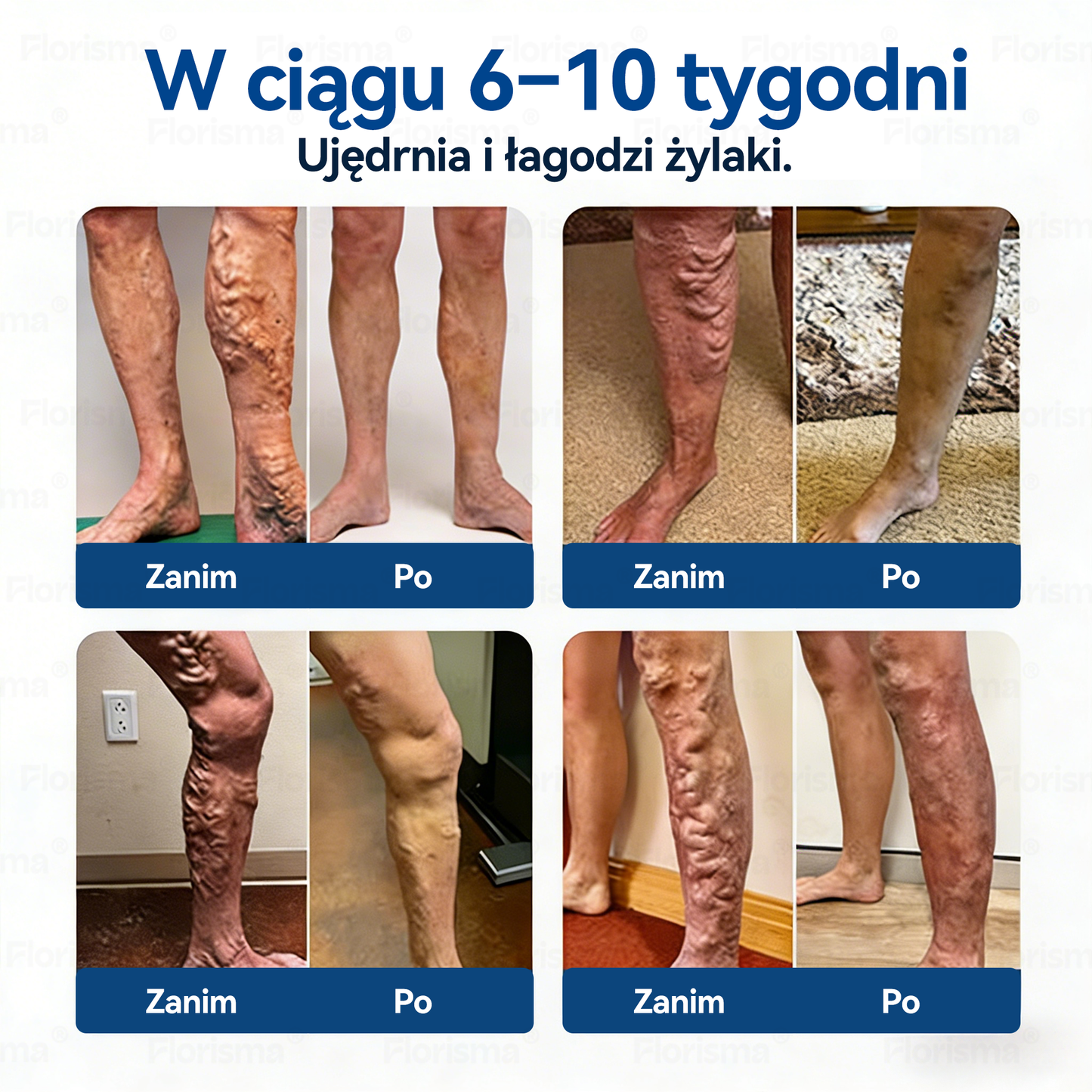 🛡️𝐹𝐿𝑂𝑅𝐼𝑆𝑀𝐴®🥰❤️𝐷𝐼𝑂𝑆𝑀𝐼𝑁𝐴 𝑖 𝐻𝐸𝑆𝑃𝐸𝑅𝑌𝐷𝑌𝑁𝐴 – 𝑃𝑙𝑎𝑠𝑡𝑒𝑟 𝑧 𝑚𝑖𝑘𝑟𝑜𝑖𝑔ł𝑎𝑚𝑖 𝑜 𝑓𝑜𝑟𝑚𝑢𝑙𝑒 𝑘𝑙𝑎𝑠𝑦 𝑘𝑙𝑖𝑛𝑖𝑐𝑧𝑛𝑒𝑗 – 𝑍𝑎𝑎𝑤𝑎𝑛𝑠𝑜𝑤𝑎𝑛𝑎 𝑚𝑖𝑒𝑠𝑧𝑎𝑛𝑘𝑎 𝑧𝑖𝑜ł𝑜𝑤𝑎 𝑧𝑤𝑎𝑙𝑐𝑧𝑎𝑗ą𝑐𝑎 𝑝𝑎𝑗ą𝑐𝑧𝑘𝑖 𝑖 𝑝𝑟𝑧𝑦𝑛𝑜𝑠𝑧ą𝑐𝑎 𝑢𝑙𝑔ę 𝑐𝑖ęż𝑘𝑖𝑚, 𝑧𝑚ę𝑐𝑧𝑜𝑛𝑦𝑚 𝑛𝑜𝑔𝑜𝑚