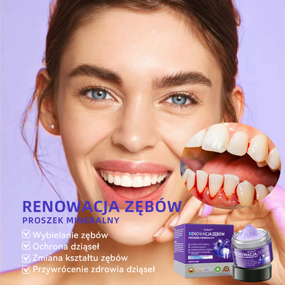 [✅Oficjalny sklep]𝐎𝐲𝐢𝐤𝐞𝐲™ Proszek mineralny do naprawy zębów 🦷 (Rekomendowane przez PTO) (🎁 Limitowana oferta - 70% zniżki - Nie przegap!)