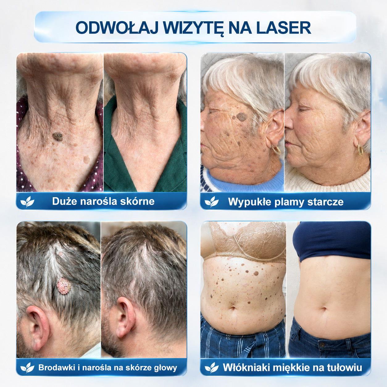 🍀👑𝐏i𝐜𝐝o® 7 𝑫𝒏𝒊 𝑷𝒓𝒆𝒑𝒂𝒓𝒂𝒕 𝑫𝒐 𝑼𝒔𝒖𝒘𝒂𝒏𝒊𝒂 𝑾łó𝒌𝒏𝒊𝒂𝒌ó𝒘 𝑴𝒊ę𝒌𝒌𝒊𝒄𝒉 𝑰 𝑷𝒓𝒛𝒆𝒃𝒂𝒓𝒘𝒊𝒆ń(𝐁𝐞𝐳 𝐁ó𝐥𝐮, 𝐁𝐞𝐳 𝐁𝐥𝐢𝐳𝐧 – 𝐑𝐨𝐥𝐥-𝐨𝐧)