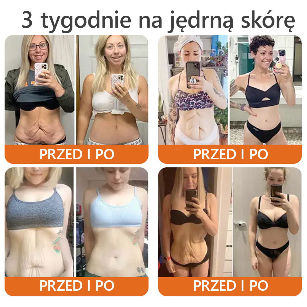 [Wyprodukowano i wysłano z Polski] 𝐃𝐨𝐫𝐦𝐨𝐫𝐧𝐚® 💕💕 𝐉𝐚𝐝 𝐏𝐬𝐳𝐜𝐳𝐞𝐥𝐢 𝐤𝐨𝐦𝐩𝐥𝐞𝐤𝐬𝐨𝐰𝐲 𝐤𝐫𝐞𝐦 🔥 OSTATNI DZIEŃ 80% ZNIŻKI
