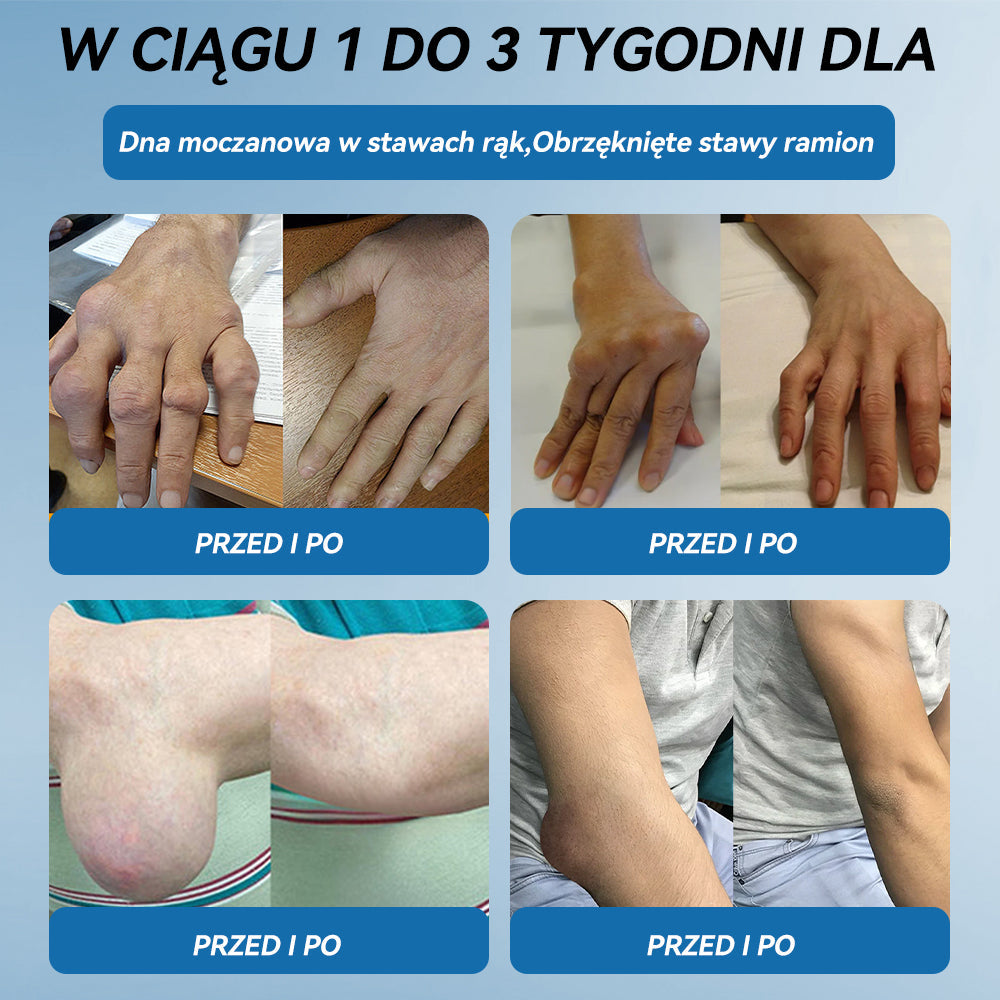 𝐎𝐟𝐢𝐜𝐣𝐚𝐥𝐧𝐲 𝐬𝐤𝐥𝐞𝐩| 👩‍⚕️🎁𝖯𝗂𝖼𝗱𝗼® 𝐵𝑃𝐶-157 𝐾𝑟𝑒𝑚 𝑑𝑜 𝑙𝑒𝑐𝑧𝑒𝑛𝑖𝑎 𝑠𝑡𝑎𝑤ó𝑤🦴𝐷𝑧𝑖𝑎ł𝑎 𝑤 5 𝑚𝑖𝑛𝑢𝑡 — 𝑙𝑒𝑐𝑧𝑦 𝑎𝑟𝑡𝑟𝑒𝑡𝑦𝑧𝑚, 𝑛𝑒𝑢𝑟𝑜𝑝𝑎𝑡𝑖ę, 𝑟𝑒𝑢𝑚𝑎𝑡𝑦𝑧𝑚, 𝑢𝑟𝑎𝑧𝑦 𝑠𝑝𝑜𝑟𝑡𝑜𝑤𝑒 𝑖 𝑖𝑛𝑛𝑒 👍