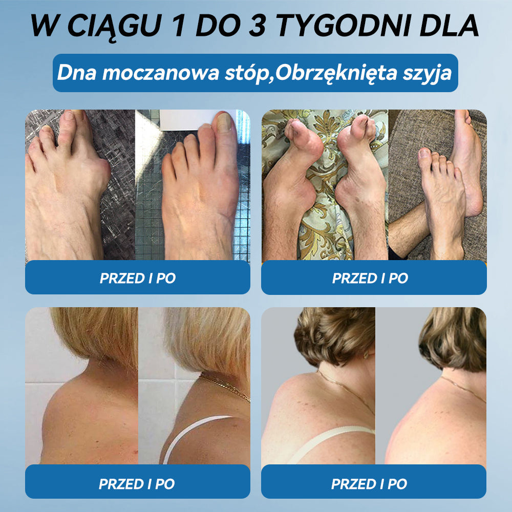 𝐎𝐟𝐢𝐜𝐣𝐚𝐥𝐧𝐲 𝐬𝐤𝐥𝐞𝐩| 👩‍⚕️🎁𝖯𝗂𝖼𝗱𝗼® 𝐵𝑃𝐶-157 𝐾𝑟𝑒𝑚 𝑑𝑜 𝑙𝑒𝑐𝑧𝑒𝑛𝑖𝑎 𝑠𝑡𝑎𝑤ó𝑤🦴𝐷𝑧𝑖𝑎ł𝑎 𝑤 5 𝑚𝑖𝑛𝑢𝑡 — 𝑙𝑒𝑐𝑧𝑦 𝑎𝑟𝑡𝑟𝑒𝑡𝑦𝑧𝑚, 𝑛𝑒𝑢𝑟𝑜𝑝𝑎𝑡𝑖ę, 𝑟𝑒𝑢𝑚𝑎𝑡𝑦𝑧𝑚, 𝑢𝑟𝑎𝑧𝑦 𝑠𝑝𝑜𝑟𝑡𝑜𝑤𝑒 𝑖 𝑖𝑛𝑛𝑒 👍