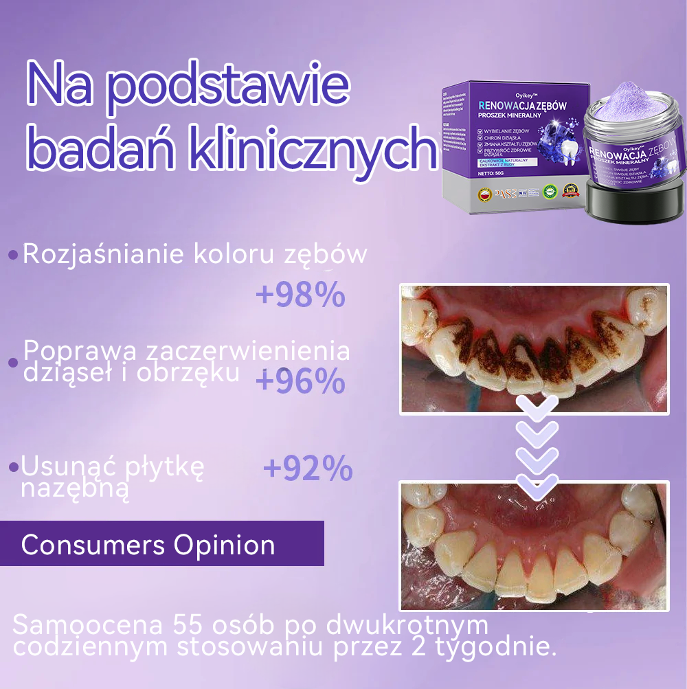 [✅Oficjalny sklep]𝐎𝐲𝐢𝐤𝐞𝐲™ Proszek mineralny do naprawy zębów 🦷 (Rekomendowane przez PTO) (🎁 Limitowana oferta - 70% zniżki - Nie przegap!)