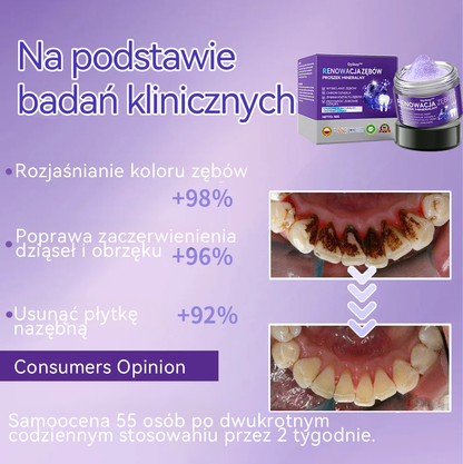 [✅Oficjalny sklep] 𝐎𝐲𝐢𝐤𝐞𝐲™ Mineralny proszek do naprawy zębów 🦷 (Zalecany przez PTO) (🎁 Ekskluzywna oferta – nie przegap!)