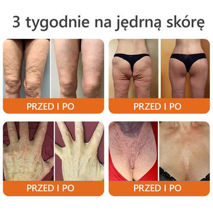 [Wyprodukowano i wysłano z Polski] 𝐃𝐨𝐫𝐦𝐨𝐫𝐧𝐚® 💕💕 𝐉𝐚𝐝 𝐏𝐬𝐳𝐜𝐳𝐞𝐥𝐢 𝐤𝐨𝐦𝐩𝐥𝐞𝐤𝐬𝐨𝐰𝐲 𝐤𝐫𝐞𝐦 🔥 OSTATNI DZIEŃ 80% ZNIŻKI