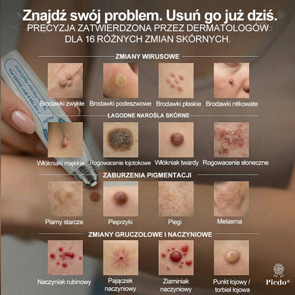 🍀👑𝐏i𝐜𝐝o® 7 𝑫𝒏𝒊 𝑷𝒓𝒆𝒑𝒂𝒓𝒂𝒕 𝑫𝒐 𝑼𝒔𝒖𝒘𝒂𝒏𝒊𝒂 𝑾łó𝒌𝒏𝒊𝒂𝒌ó𝒘 𝑴𝒊ę𝒌𝒌𝒊𝒄𝒉 𝑰 𝑷𝒓𝒛𝒆𝒃𝒂𝒓𝒘𝒊𝒆ń(𝐁𝐞𝐳 𝐁ó𝐥𝐮, 𝐁𝐞𝐳 𝐁𝐥𝐢𝐳𝐧 – 𝐑𝐨𝐥𝐥-𝐨𝐧)