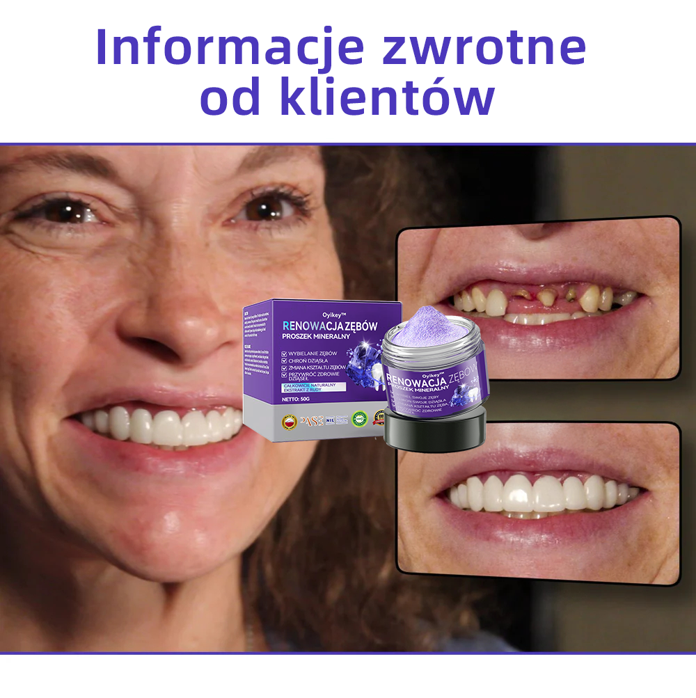 [✅Oficjalny sklep]𝐎𝐲𝐢𝐤𝐞𝐲™ Proszek mineralny do naprawy zębów 🦷 (Rekomendowane przez PTO) (🎁 Limitowana oferta - 70% zniżki - Nie przegap!)