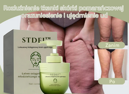 (🔥 Ostatni dzień specjalnej oferty - 70% zniżki 🔥) STDEI™ 💧 Luksusowy krem ujędrniający z kolagenem (Wyprodukowano w Polsce, certyfikat CE)