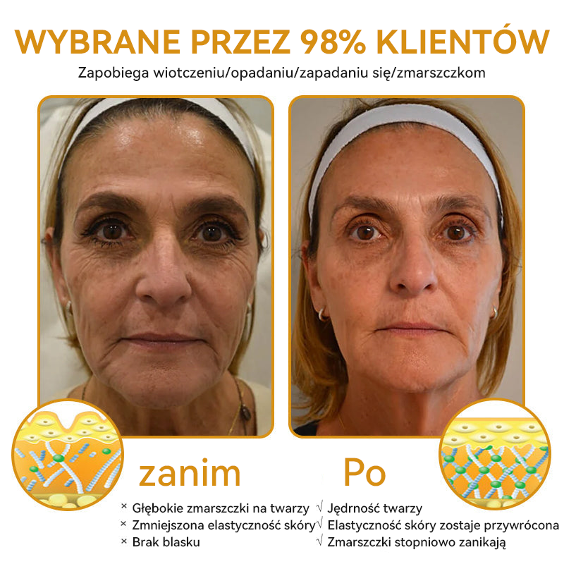 (✅ Oficjalny sklep) Spzv™ Krem 𝐁𝐨𝐭𝐨𝐱 przeciwzmarszczkowy (Ekskluzywna oferta – nie przegap!)