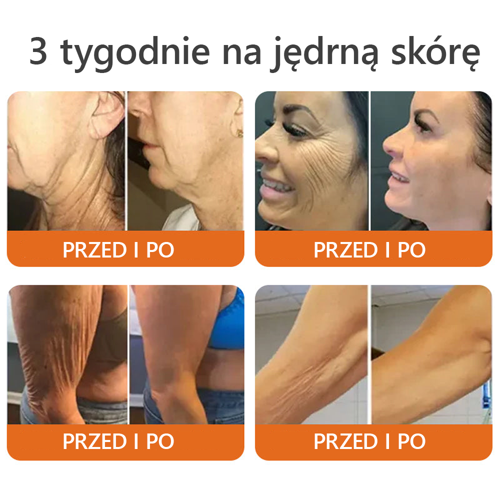 [Wyprodukowano i wysłano z Polski] 𝐃𝐨𝐫𝐦𝐨𝐫𝐧𝐚® 💕💕 𝐉𝐚𝐝 𝐏𝐬𝐳𝐜𝐳𝐞𝐥𝐢 𝐤𝐨𝐦𝐩𝐥𝐞𝐤𝐬𝐨𝐰𝐲 𝐤𝐫𝐞𝐦 🔥 OSTATNI DZIEŃ 80% ZNIŻKI
