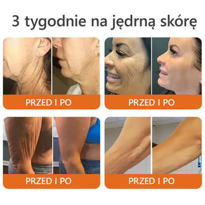 [Wyprodukowano i wysłano z Polski] 𝐃𝐨𝐫𝐦𝐨𝐫𝐧𝐚® 💕💕 𝐉𝐚𝐝 𝐏𝐬𝐳𝐜𝐳𝐞𝐥𝐢 𝐤𝐨𝐦𝐩𝐥𝐞𝐤𝐬𝐨𝐰𝐲 𝐤𝐫𝐞𝐦 🔥 OSTATNI DZIEŃ 80% ZNIŻKI