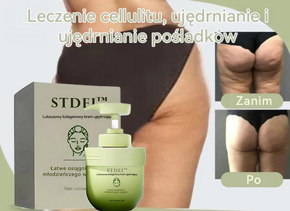 (🔥 Ostatni dzień specjalnej oferty - 70% zniżki 🔥) STDEI™ 💧 Luksusowy krem ujędrniający z kolagenem (Wyprodukowano w Polsce, certyfikat CE)