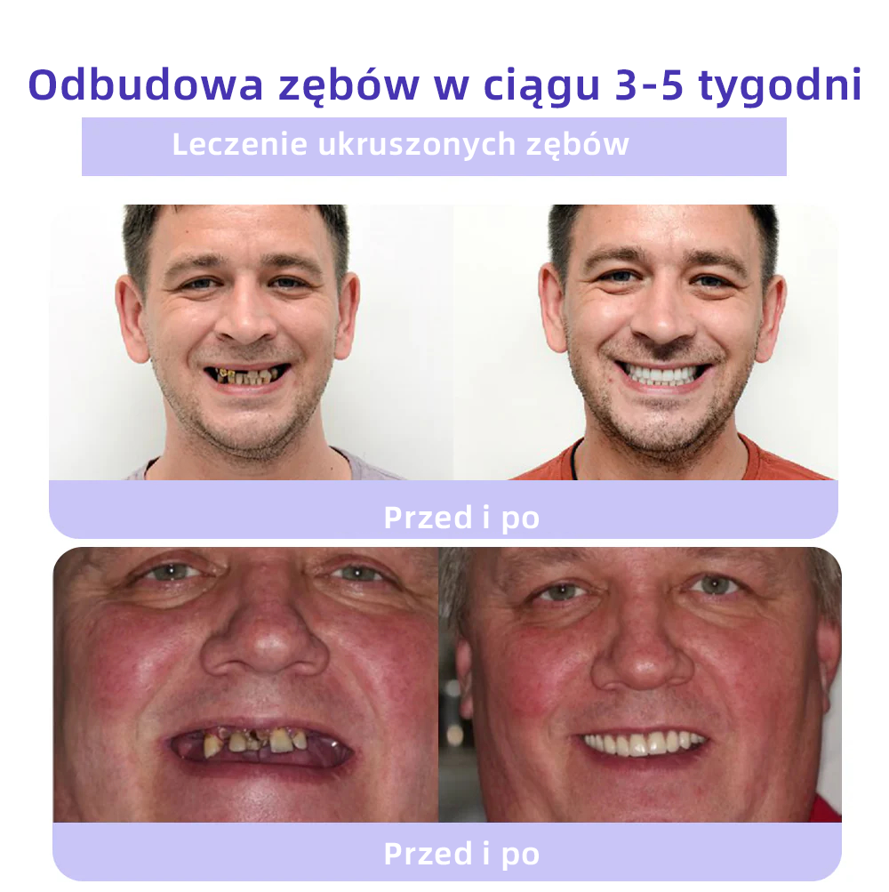 [✅Oficjalny sklep] 𝐎𝐲𝐢𝐤𝐞𝐲™ Mineralny proszek do naprawy zębów 🦷 (Zalecany przez PTO) (🎁 Ekskluzywna oferta – nie przegap!)