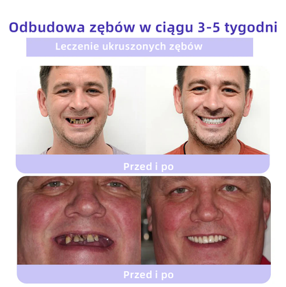 [✅Oficjalny sklep]𝐎𝐲𝐢𝐤𝐞𝐲™ Proszek mineralny do naprawy zębów 🦷 (Rekomendowane przez PTO) (🎁 Limitowana oferta - 70% zniżki - Nie przegap!)