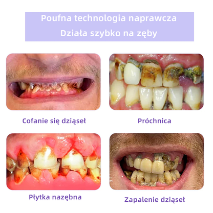 [✅Oficjalny sklep] 𝐎𝐲𝐢𝐤𝐞𝐲™ Mineralny proszek do naprawy zębów 🦷 (Zalecany przez PTO) (🎁 Ekskluzywna oferta – nie przegap!)