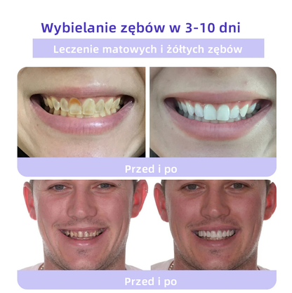 [✅Oficjalny sklep] 𝐎𝐲𝐢𝐤𝐞𝐲™ Mineralny proszek do naprawy zębów 🦷 (Zalecany przez PTO) (🎁 Ekskluzywna oferta – nie przegap!)