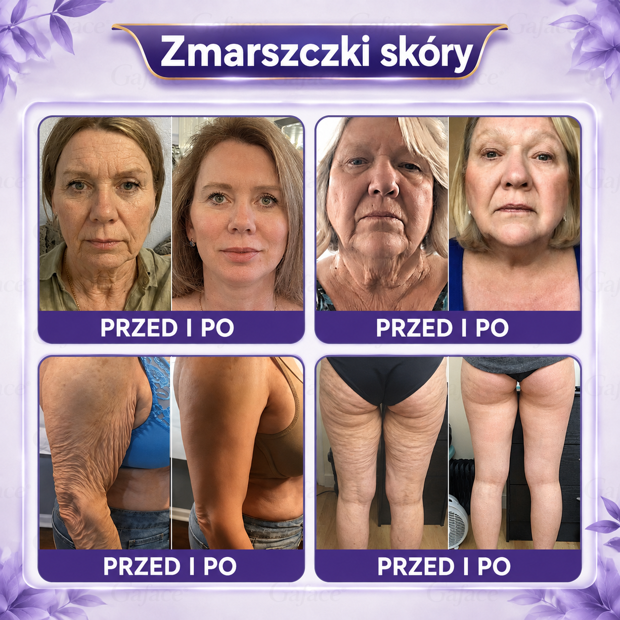 🥇🐉𝐆𝐚𝐟𝐚𝐜𝐞® 𝐊𝐨𝐥𝐚𝐠𝐞𝐧 𝐅𝐮𝐥𝐥𝐞𝐫𝐞𝐧 𝐖𝐚ł𝐞𝐜𝐳𝐞𝐤 𝐔𝐣ę𝐝𝐫𝐧𝐢𝐚𝐣ą𝐜𝐲 𝐊𝐫𝐞𝐦